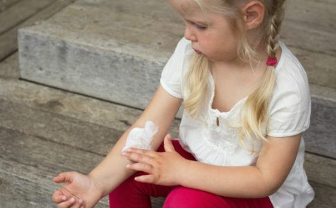 Kleines Mädchen reibt sich eine juckende Hauptpartie am Arm mit Creme ein