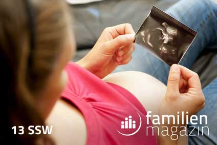 SSW 13 Schwangerschaft Ultraschall