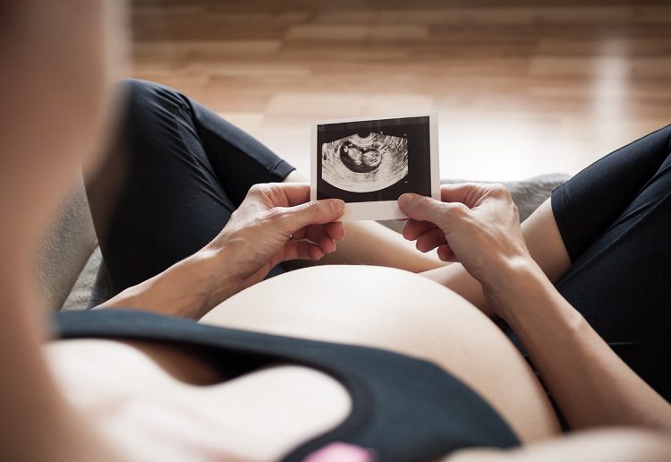 Mutter schaut sich Ultraschallbild und ihren Babybauch an.